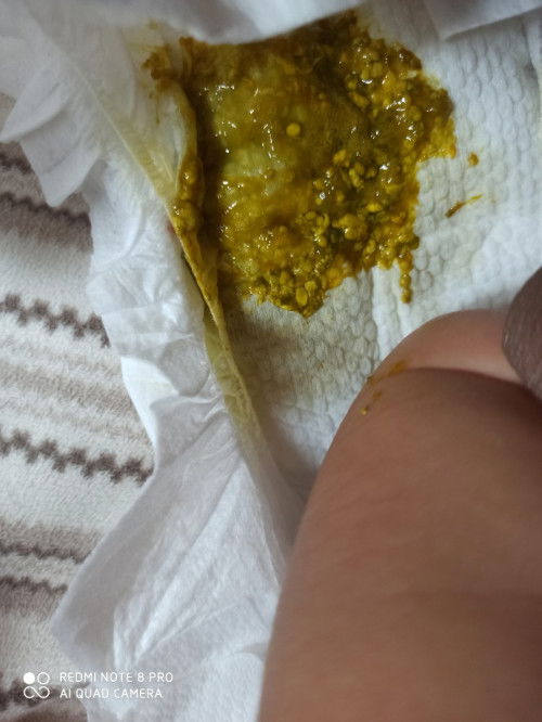 Bab bayi asi warna hijau