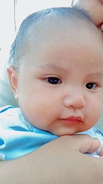 ลูกมีคราบขาวๆบนใบหน้ามีวิธีรักษาไหมชื่อยาที่ร้านหมอมาทาก็ไ่ม่หายเเถมเป็นกว้างกว่าเดิม