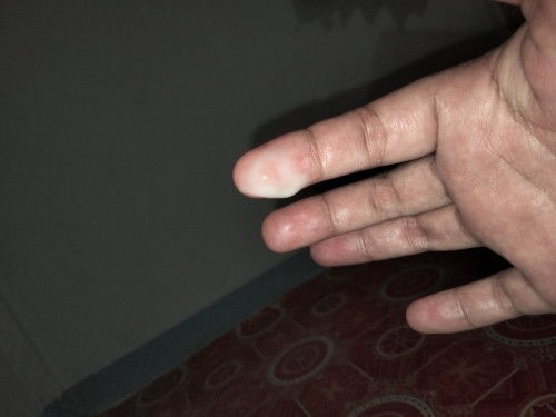 แบบนี้คืออะไรค่ะ สัญญานเตือนหรือปล่าว