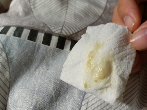 ตกขาวสีเขียวอ่อน