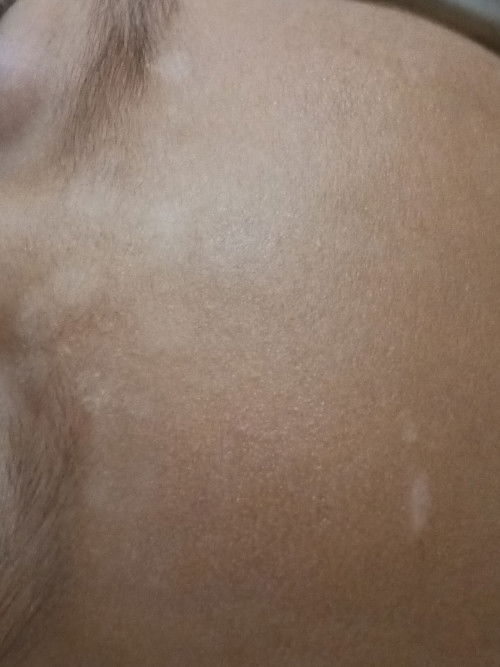 Kenapa jidat anak saya pada putih begitu iya ?