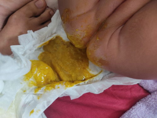 Hai.. nak tanya ...normal ke kalau mcm ni ya ... Dilema ni kne tukar susu ke ya