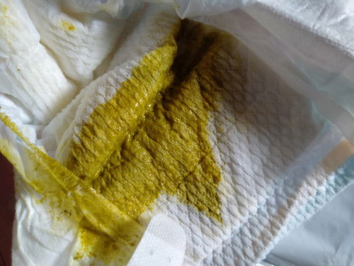 Pup Bayi Normal atau Tidak?