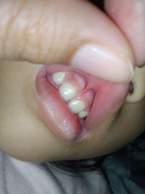 Ini lip tie enggak sih ?