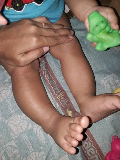 Kaki bayi 9 bulan mash bengkok wajar kan bun?
