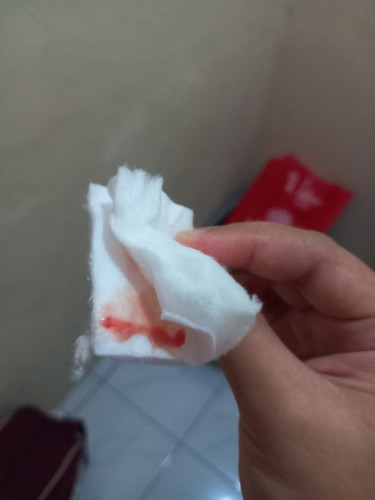 Lendir darah usia kandungan 39 pekan +3 hari