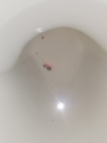 Brown discharge