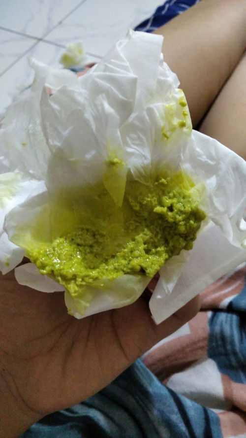 Feses bayi 1bulan warna hijau