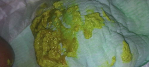 Normal po ba ang poop ni baby 1 month and 9 days na sya