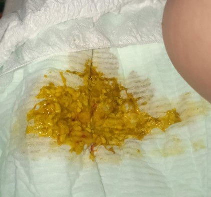 Bab bayi 2 bulan 13 hr