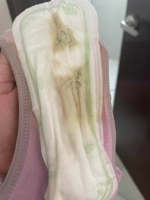 Tanda nak bersalin ke?