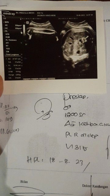 Usg, hpl jadi mundur