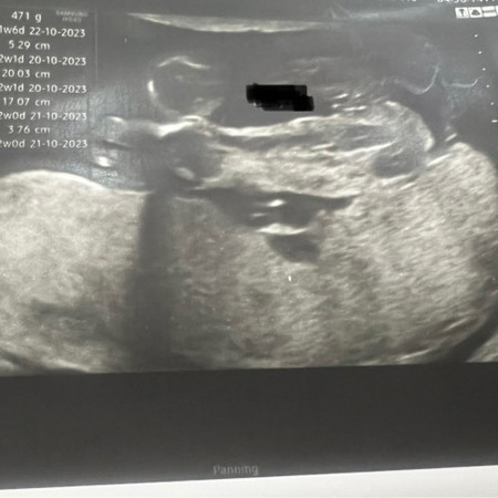 nak comfirm dgn mummy semua yg pnah scan gender klu mcm ni nmpak boy or girl?