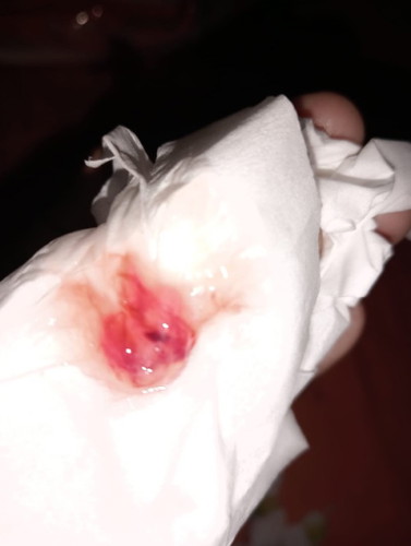 Mohon maaf kalau keluar seperti ini artinya apa yaa ? Soalnya pas lagi berhenti badan.
