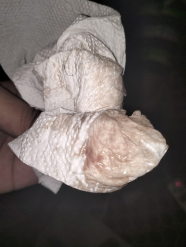 39week กระตุ้น