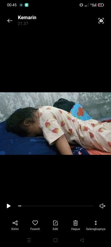 Perilaku Anak yg tengkurap dan mengejan