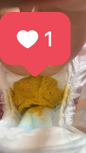 Najis ni normal?