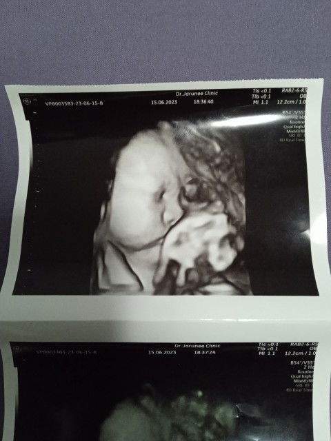 ลูกชาย33สัปดาห์แล้วค่ะ