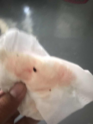 มีมูกและเลือกออก