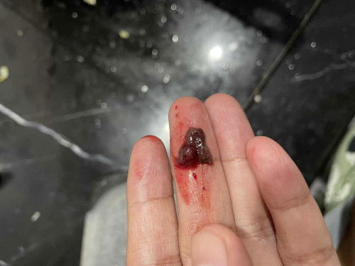 Apakah ini keguguran?!