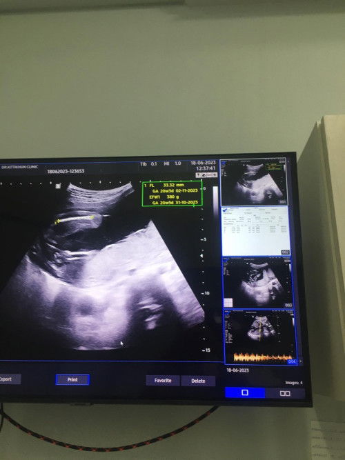 ทีมตุลาเพศไหนกันบ้าง