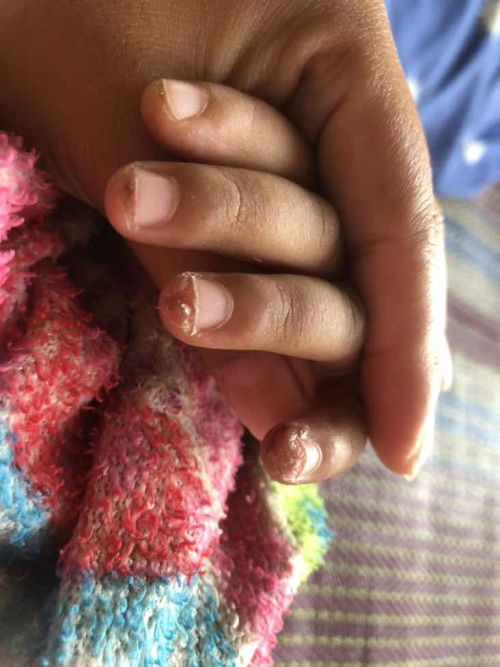 ปลายนิ้วลูกลอก