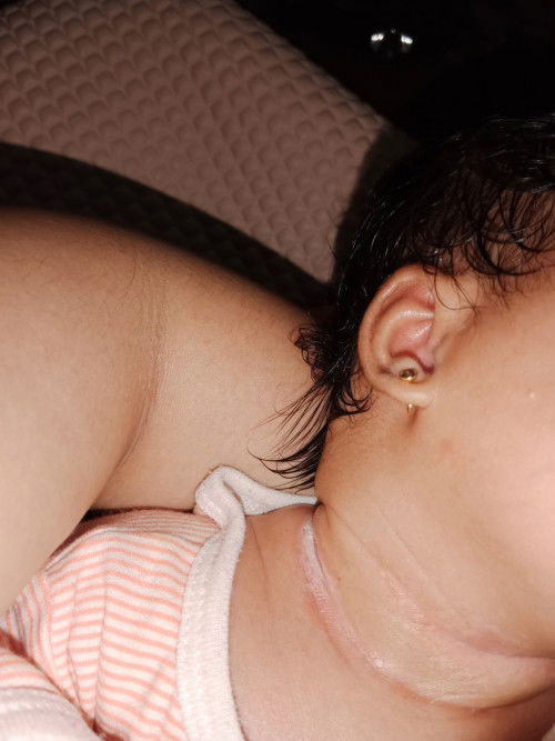 leher bayi putih dan basah