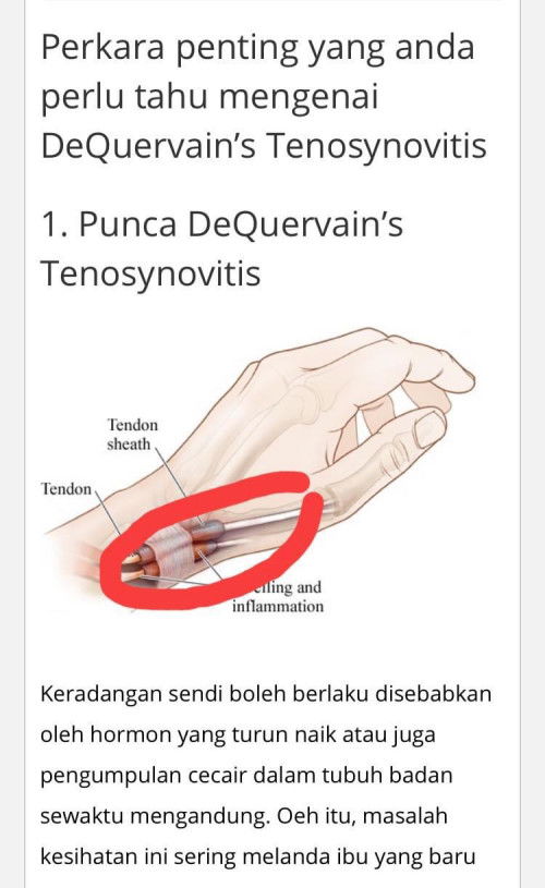 sakit pergelangan tangan