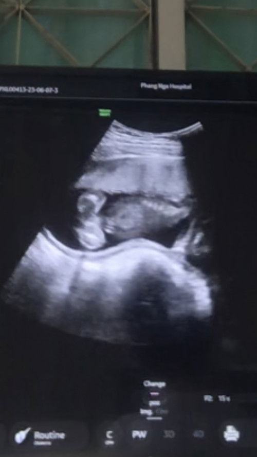 ผู้หญิงหรือผู้ชายเอ่ยยย?