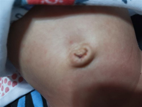 LOOB NG PUSOD NI BABY