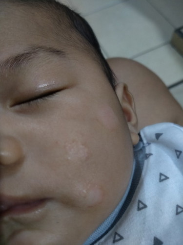 Kulit bayi