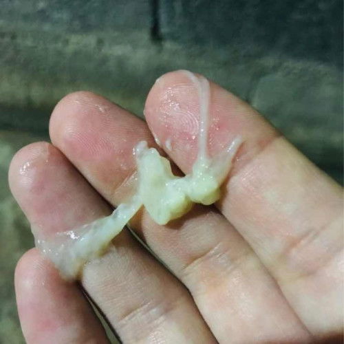 39วีค ขอคำแนะนำหน่อยค่ะ