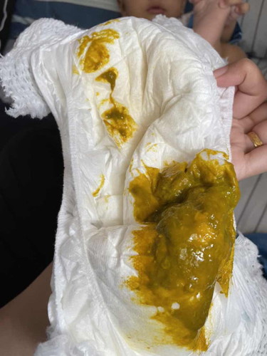 Najis anak yang sedang selsema