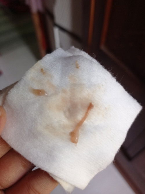 Lendir atau keputihan