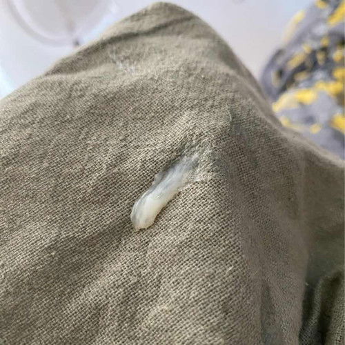 มีมูกใสๆออกมา อายุครรภ์37+2 วีค ท้องที่3