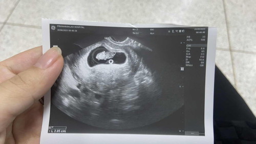 แบ่งปันภาพอัลตราซาวด์9w กันค่ะ