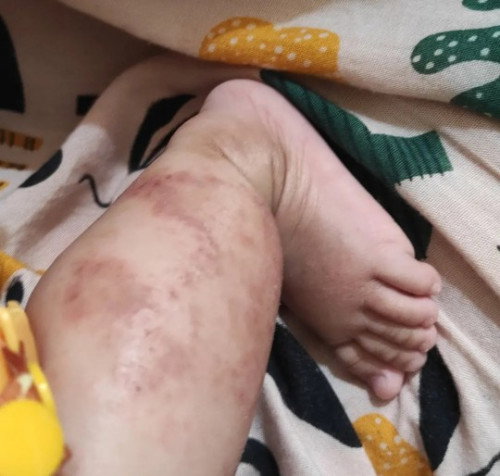 Kulit bayi 6 bulan