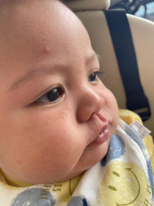 สอบถามแม่ๆนะคะ น้องแพ้อะไรมั้ยคะ