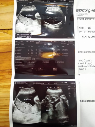 Ultrasound