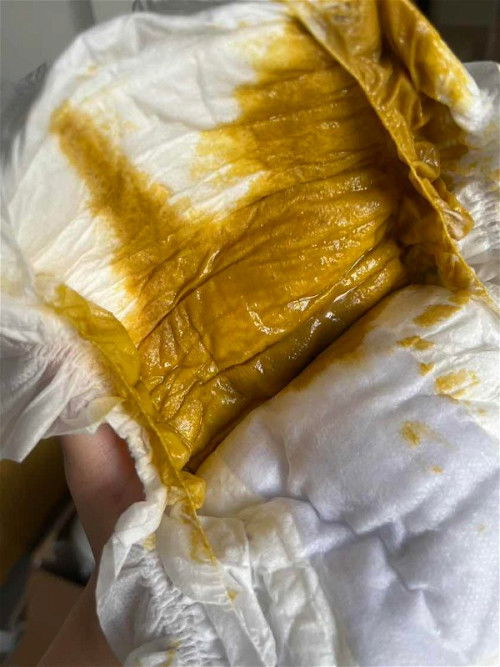 Normal ke najis baby umur 4 bulan macam ni?