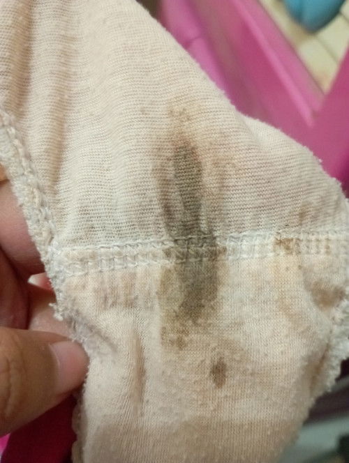 Flek cokelat tanda mau mens atau hamil?
