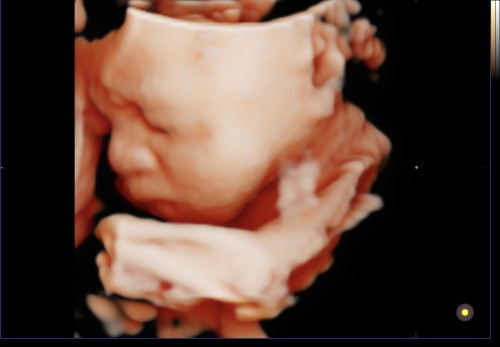 อาการเจ็บท้องคลอดเป็นอย่างไรคะ