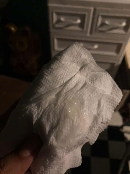 ไม่ทราบว่าแบบนี้เรียกว่าตกขาวใสหรือมูกใสหรอคะ