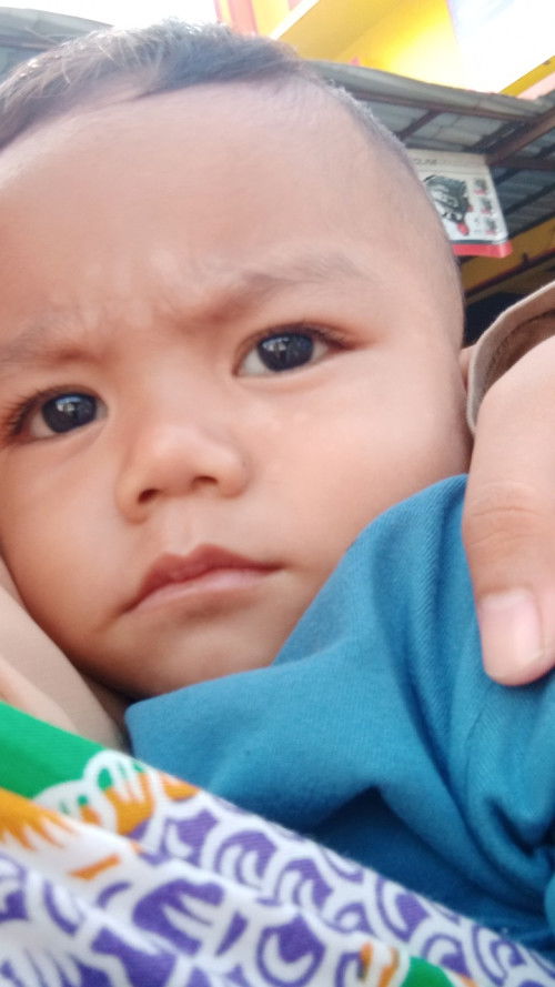 Cara hilangkan panu pada anak bayi gmn ya?