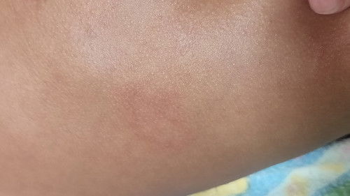 Melingkar dan agak kasar