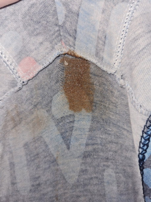 Vaginal Discharge