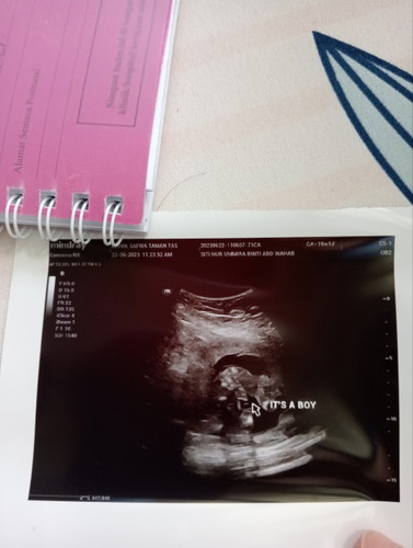 Mohon mommy² dlm ni saya nk tau ni conferm gender bby boy ye? Siapa yg berpengalaman dpt bby boy.