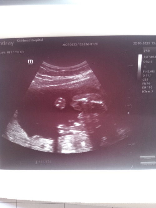 หมอดนัด ซาวด์