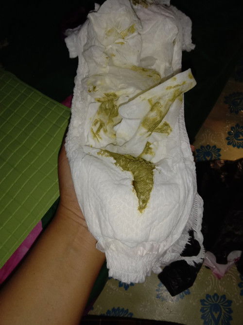5 hari tidak bab usia 2 bulan 25 hari asi + sufor