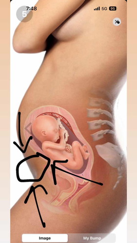 19w4d perut mengeras